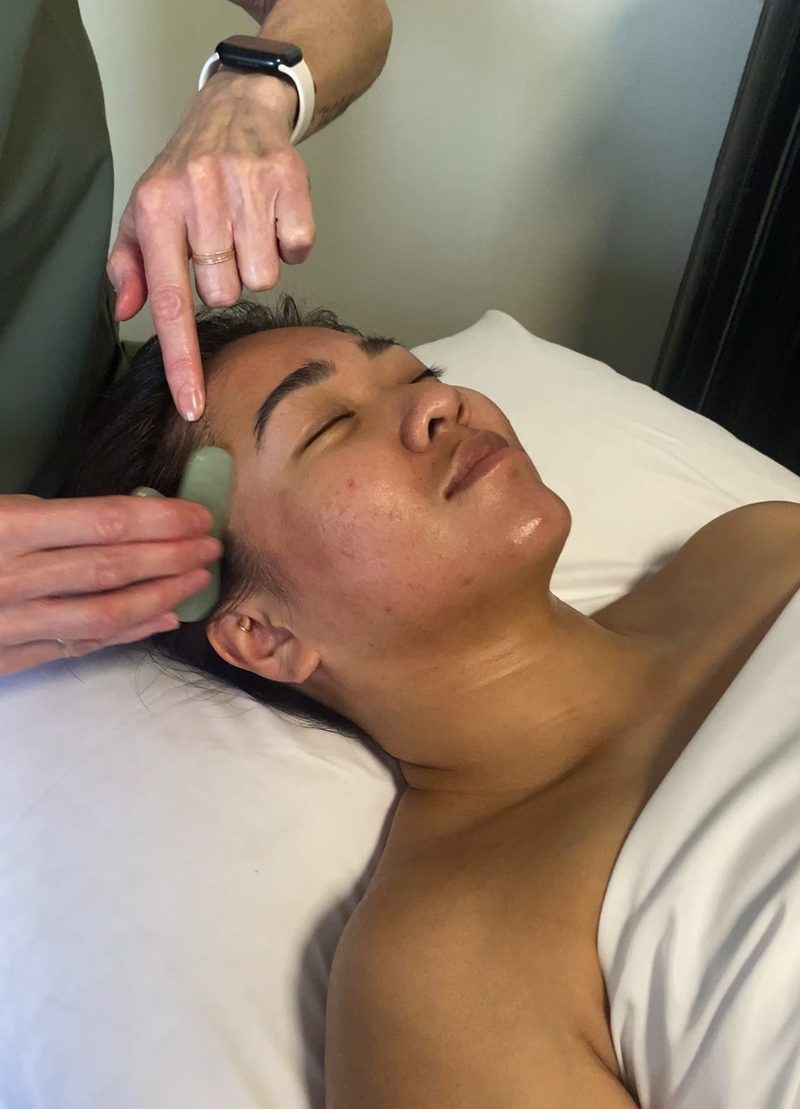 Acupuncture treatment at The Healing Theory